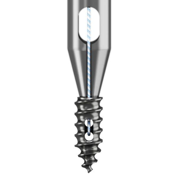 Arpón para anclaje óseo simple, sutura BT Fiber con aguja 2.2 titanio