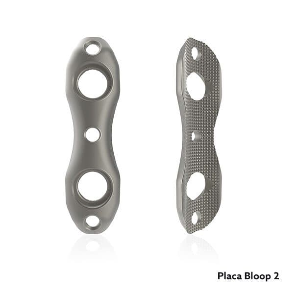 BLOOP 2 – placa para sindesmosis tibioperonea