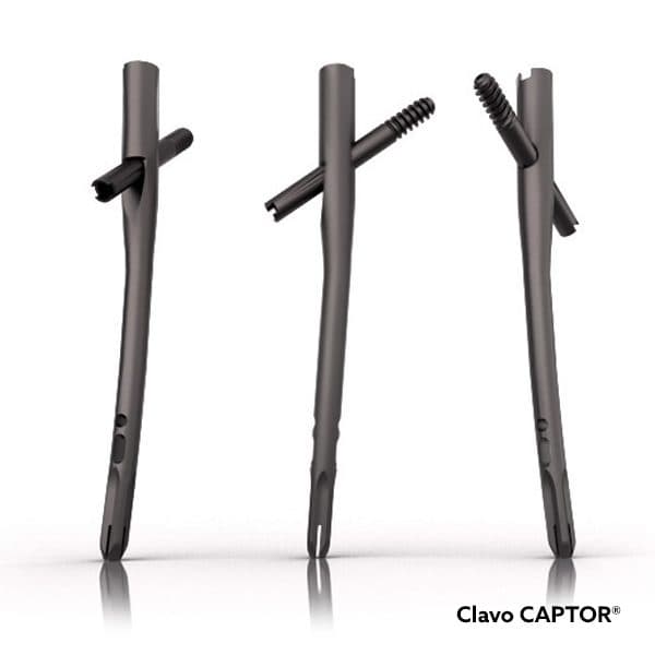 Clavo CAPTOR